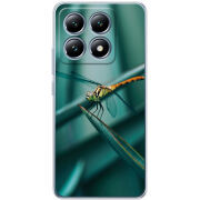 Чехол BoxFace Xiaomi 14T 