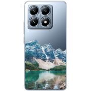 Прозрачный чехол BoxFace Xiaomi 14T Blue Mountain