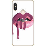 Чехол Uprint Xiaomi Redmi Note 5 / Note 5 Pro 