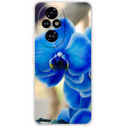 Чохол BoxFace Honor 200 