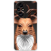 Чохол BoxFace Honor 200 