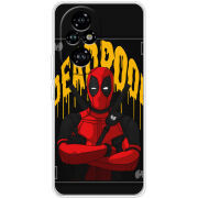 Чохол BoxFace Honor 200 