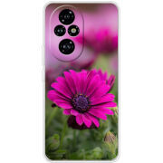 Чохол BoxFace Honor 200 