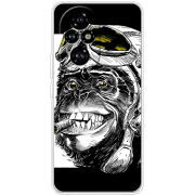 Чохол BoxFace Honor 200 