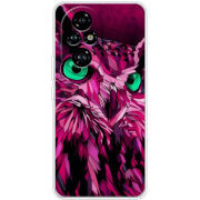 Чохол BoxFace Honor 200 