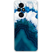 Чохол BoxFace Honor 200 