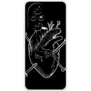 Чохол BoxFace Honor 200 