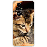 Чохол BoxFace Honor 200 