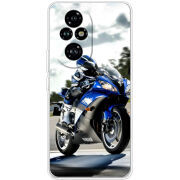 Чохол BoxFace Honor 200 