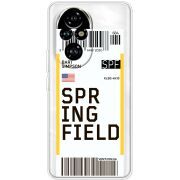 Прозорий чохол BoxFace Honor 200 Ticket Springfield