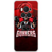 Чехол BoxFace Honor Magic 6 Pro 