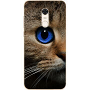 Чехол Uprint Xiaomi Redmi 5 Plus Cat's Eye