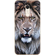 Чехол Uprint Xiaomi Redmi 5 Plus 