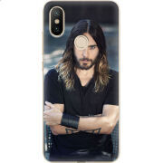 Чехол Uprint Xiaomi Mi6X / Mi A2 