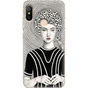 Чехол U-print Xiaomi Mi A2 Lite 