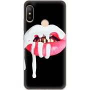 Чехол U-print Xiaomi Mi A2 Lite 