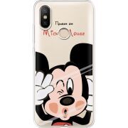 Прозрачный чехол Uprint Xiaomi Mi 6X / A2 Mister M