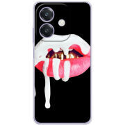 Чохол BoxFace OPPO A3 