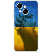 Чохол BoxFace Tecno Go 1 Handshake