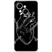 Чохол BoxFace Tecno Go 1 