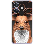 Чохол BoxFace OPPO A3x 