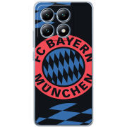 Чохол BoxFace Xiaomi 14T Pro FC Bayern