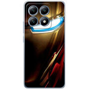 Чохол BoxFace Xiaomi 14T Pro 