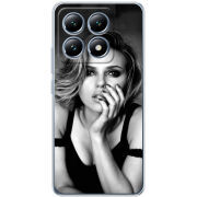 Чохол BoxFace Xiaomi 14T Pro 