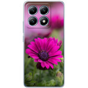 Чохол BoxFace Xiaomi 14T Pro 