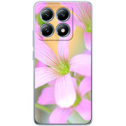 Чохол BoxFace Xiaomi 14T Pro 