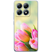 Чохол BoxFace Xiaomi 14T Pro Bouquet of Tulips