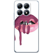 Чохол BoxFace Xiaomi 14T Pro 