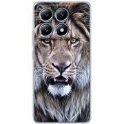 Чохол BoxFace Xiaomi 14T Pro 