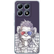 Чохол BoxFace Xiaomi 14T Pro 