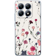 Чохол BoxFace Xiaomi 14T Pro 