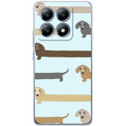 Чохол BoxFace Xiaomi 14T Pro Dachshund