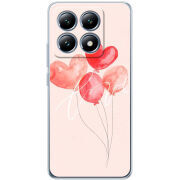 Чохол BoxFace Xiaomi 14T Pro 