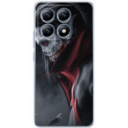 Чохол BoxFace Xiaomi 14T Pro 