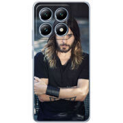 Чохол BoxFace Xiaomi 14T Pro 