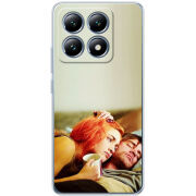 Чохол BoxFace Xiaomi 14T Pro 