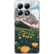 Чохол BoxFace Xiaomi 14T Pro 