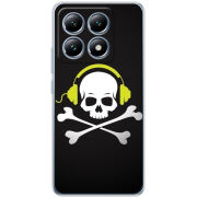 Чохол BoxFace Xiaomi 14T Pro 