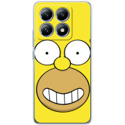 Чохол BoxFace Xiaomi 14T Pro 