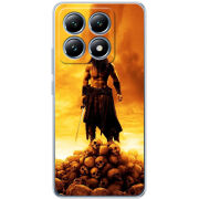 Чохол BoxFace Xiaomi 14T Pro 