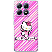 Чохол BoxFace Xiaomi 14T Pro 