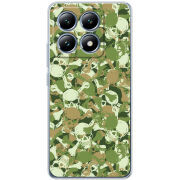 Чохол BoxFace Xiaomi 14T Pro 
