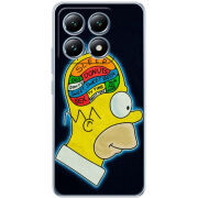 Чохол BoxFace Xiaomi 14T Pro 