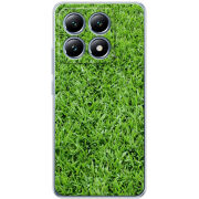 Чохол BoxFace Xiaomi 14T Pro 