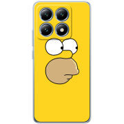 Чохол BoxFace Xiaomi 14T Pro 