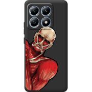 Чорний чохол BoxFace Xiaomi 14T Pro Титан